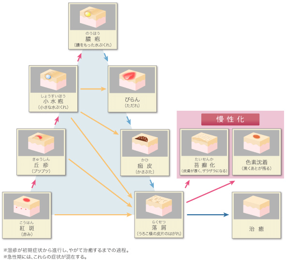 基本解説 皮膚トラブルが起こるメカニズム 田辺三菱製薬 ヒフノコトサイト