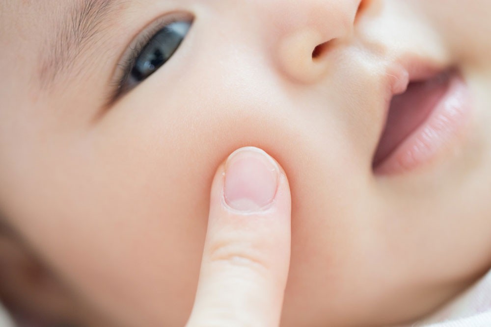 生後1〜2か月に見られる「乳児脂漏性湿疹」って？