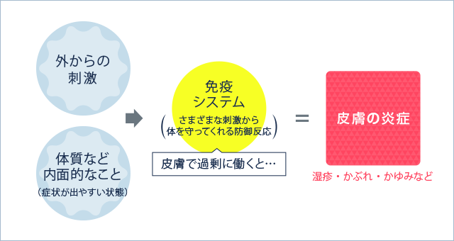 外からの刺激、体質など内面的なこと（症状が出やすい状態）→ 免疫システム（さまざまな刺激から体を守ってくれる防御反応）、皮膚で過剰に働くと… = 皮膚の炎症(湿疹・かぶれ・かゆみなど)