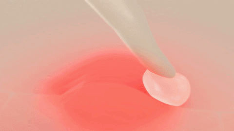 炎症を抑える効果が高い、ストロングランクステロイド配合の皮膚薬「フルコート®f」